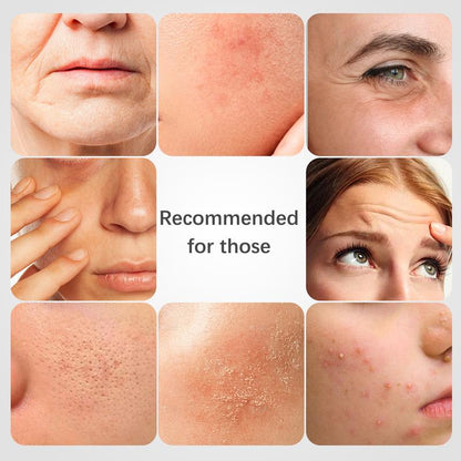 ISTON Deep Moisturizing Collagen Mask, Moisturizing Night Cream for All Skin Types - Improves Dullness, Anti-Aging, Soothes and Repairs Skinoothes