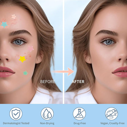 Cute Star Pimple Patches – Colorful Hydrocolloid Acne Stickers with Tea Tree & Cica